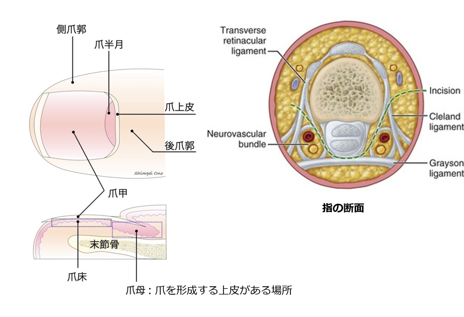 指尖部外傷(爪脱臼、爪下血腫)を診察する。Schiller法を知ってるかい? | 救急医の頭ん中。