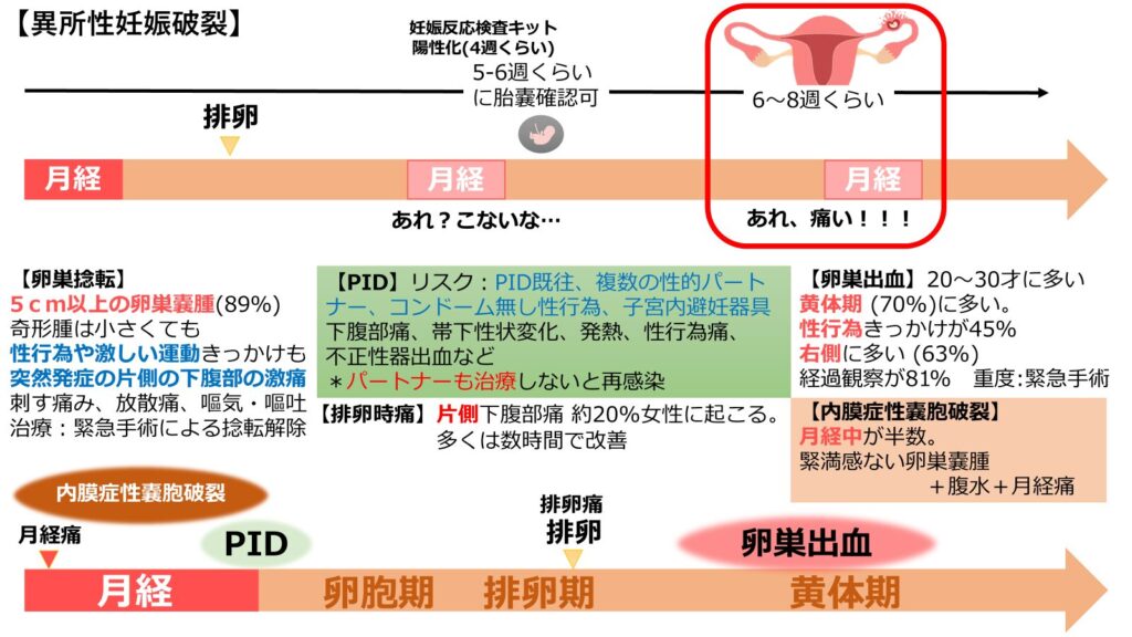 月経と腹痛の原因のイマージ
